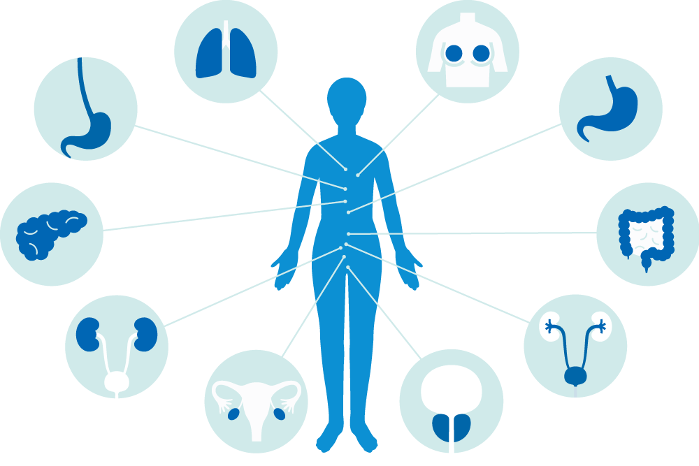 miSignalで検査可能ながん種：肺・乳・胃・腎臓・大腸・前立腺・膀胱・卵巣・すい臓・食道