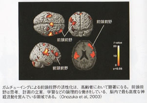 認知症