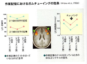 認知症