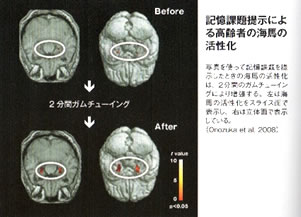 認知症