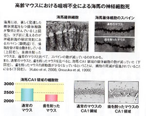 認知症