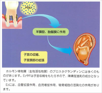 歯周病