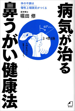 慢性上咽頭炎の治療に関しての詳細