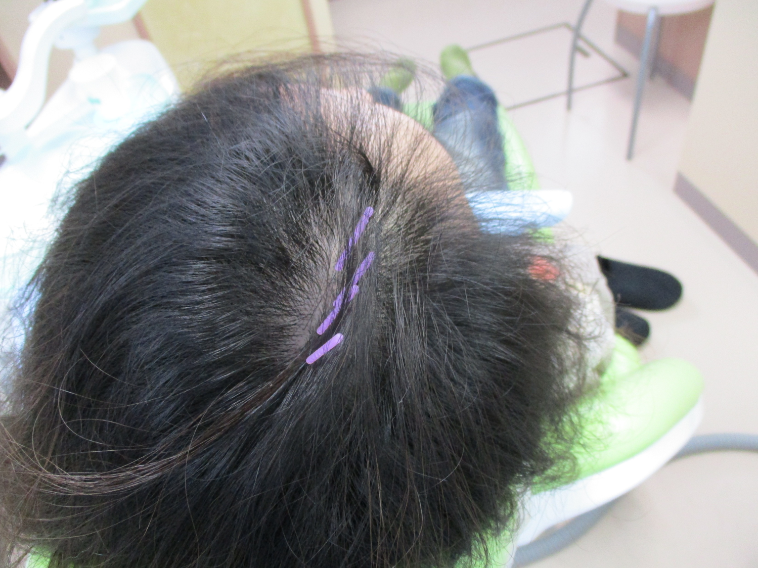 顔面・口腔内激痛