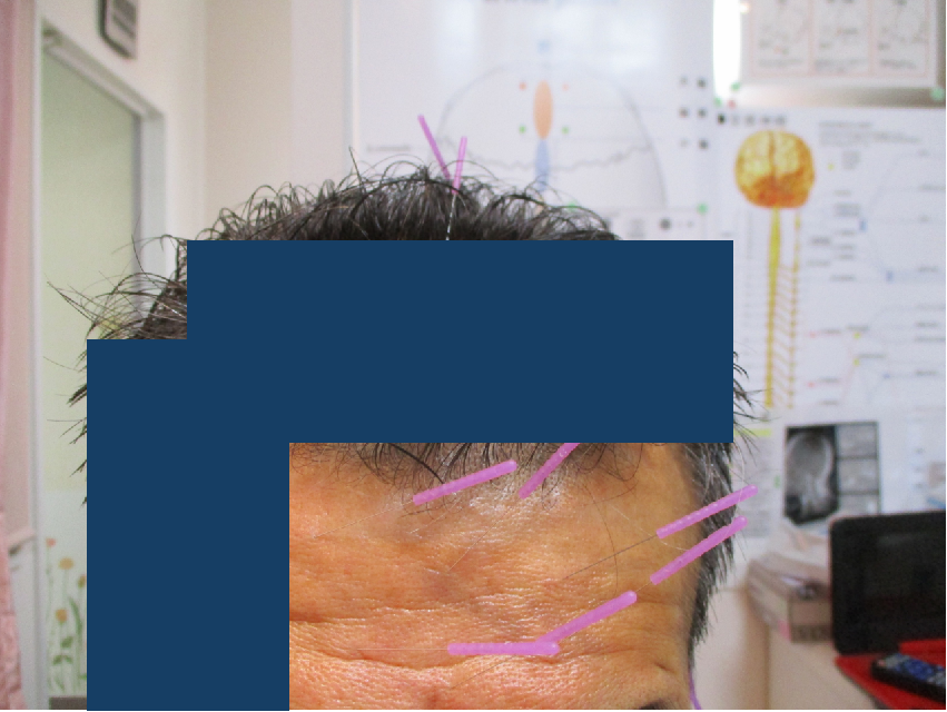 味覚・嗅覚障害